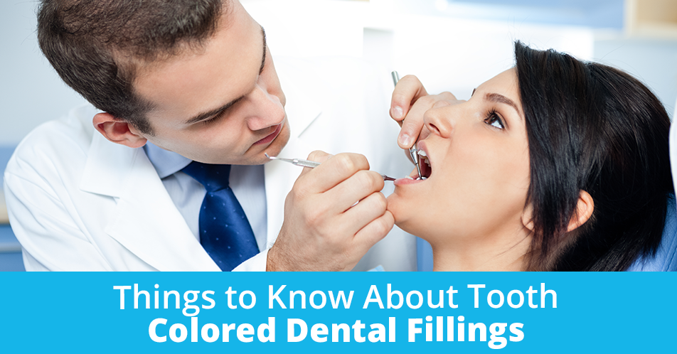 Things to Know About Tooth Colored Dental Fillings