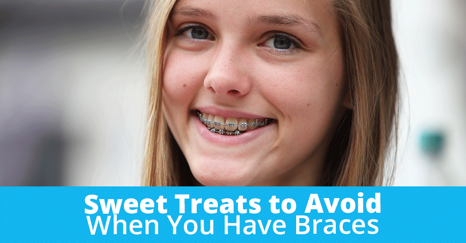 Sweet Treats to Avoid When You Have Braces
